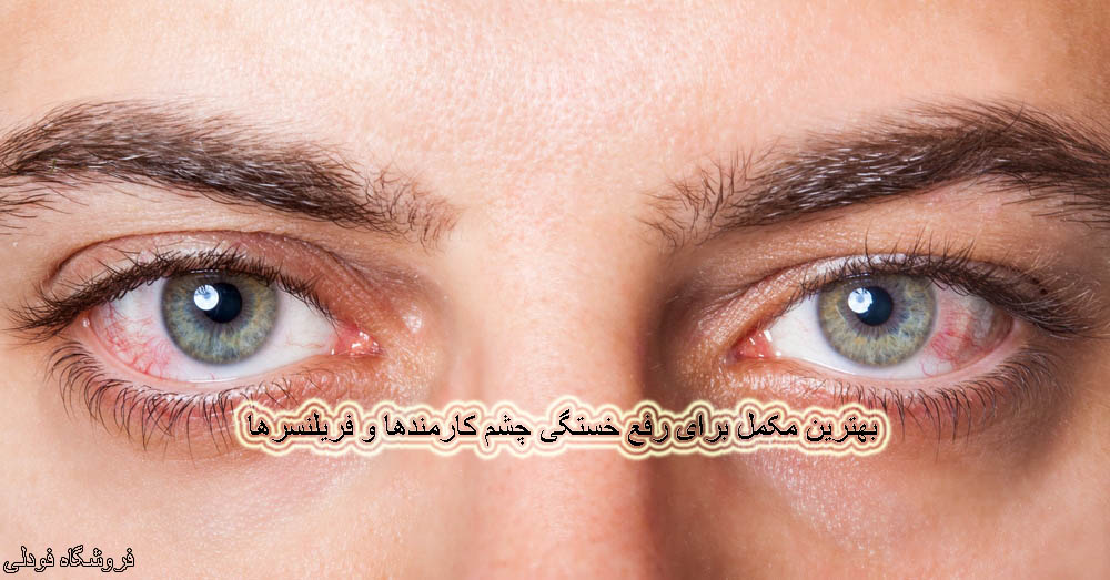 مکمل برای رفع خستگی چشم