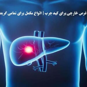 بهترین قرص خارجی برای کبد چرب| انواع مکمل برای تمامی گریدها